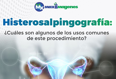 Histerosalpingografía